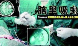 寄生大脑在线观看,跟随寄生大脑探索神秘脑域