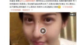 整形手术爆料视频大全集,爆料视频大全集深度解析