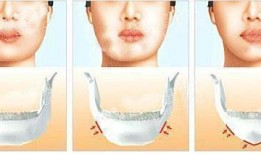 整形手术爆料视频大全集,爆料视频大全集深度解析